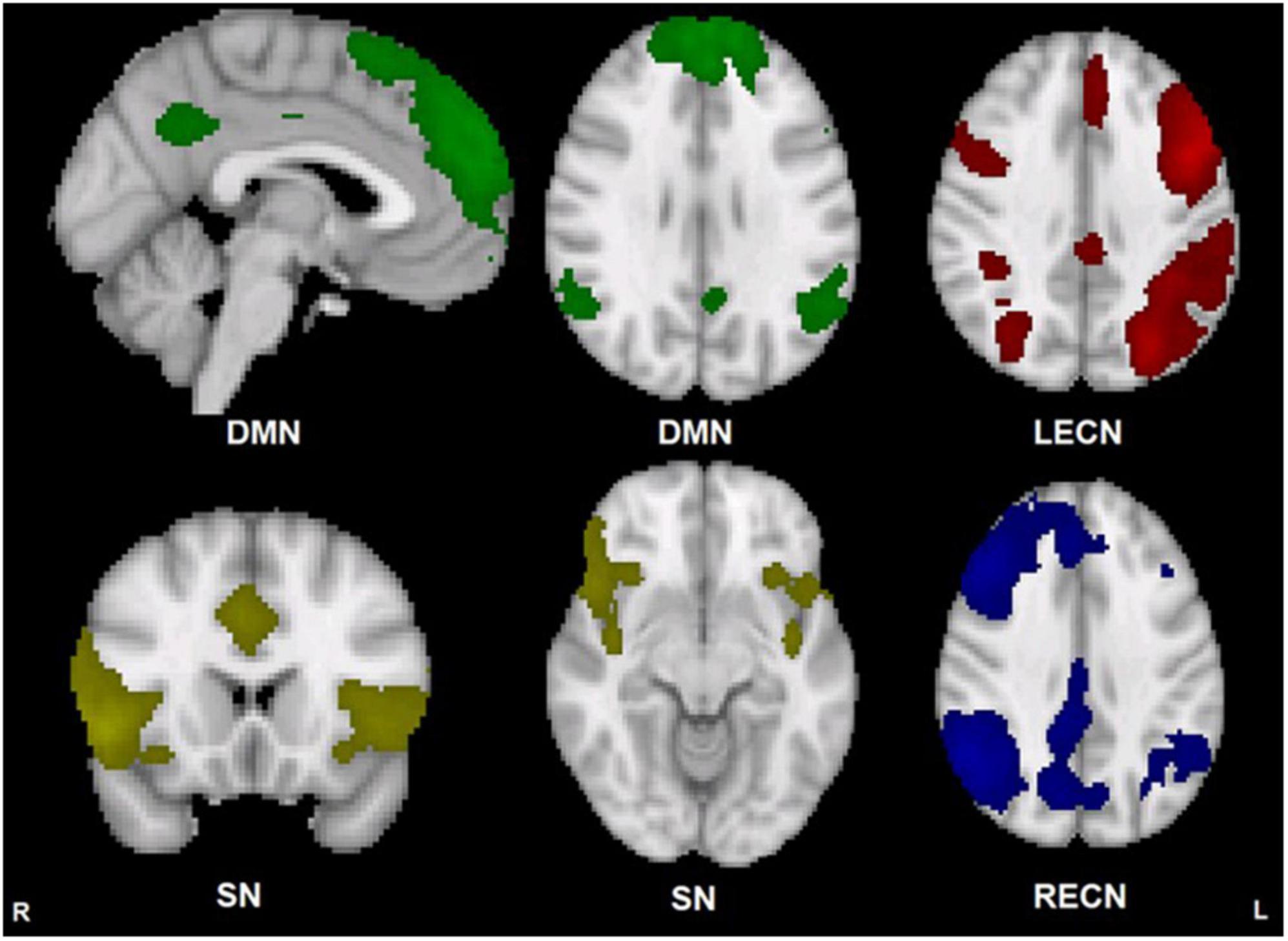 Executive control network resting state fMRI functional and effective connectivity and delay discounting in cocaine dependent subjects compared to healthy controls